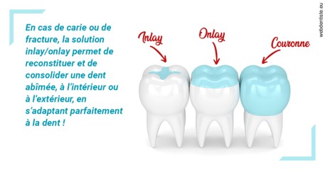 https://dr-gritli-soraya.chirurgiens-dentistes.fr/L'INLAY ou l'ONLAY