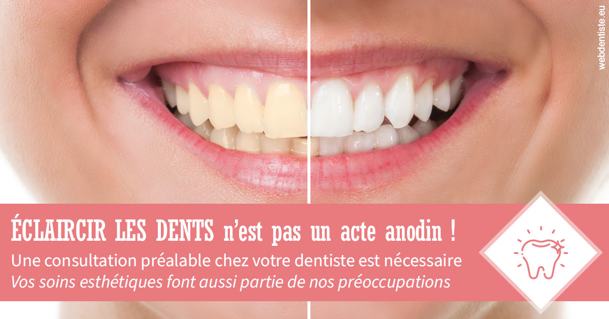 https://dr-gritli-soraya.chirurgiens-dentistes.fr/Eclaircir les dents 1