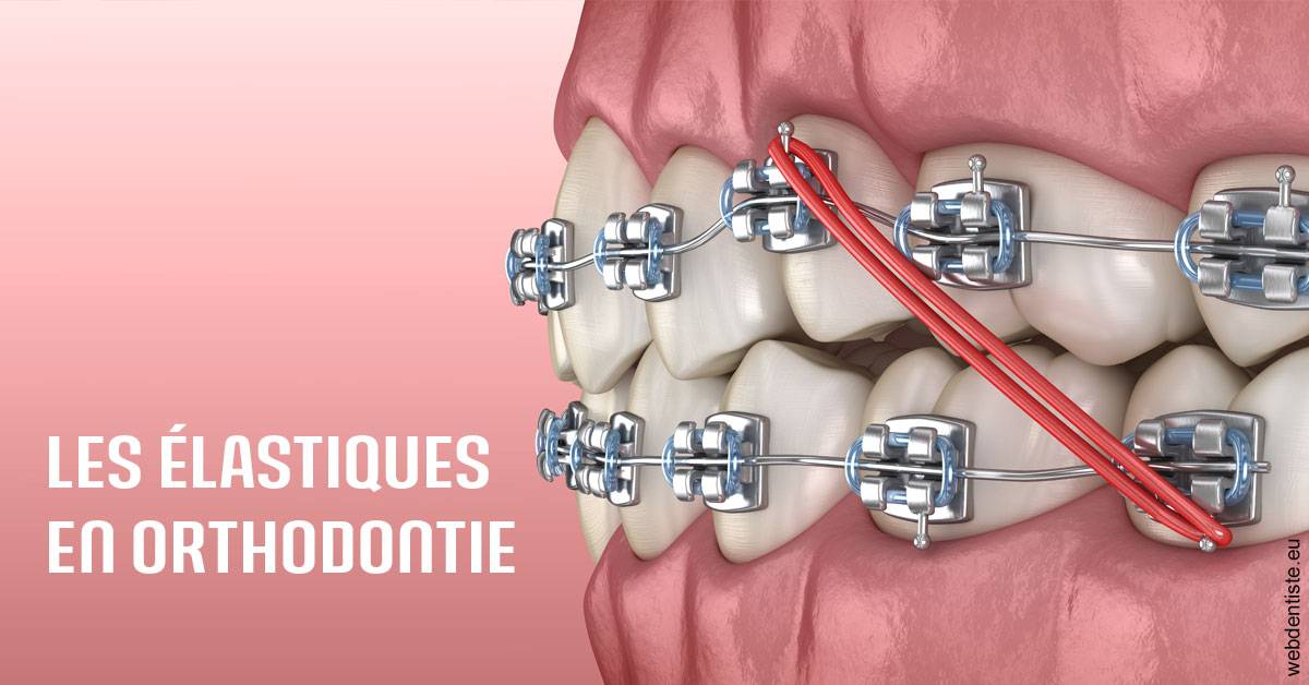 https://dr-gritli-soraya.chirurgiens-dentistes.fr/Elastiques orthodontie 2