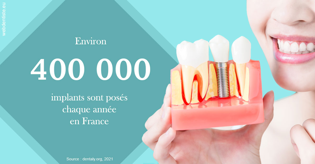 https://dr-gritli-soraya.chirurgiens-dentistes.fr/Pose d'implants en France 2
