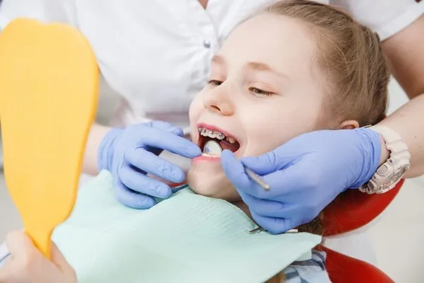 Questions les plus fréquentes sur orthodontie